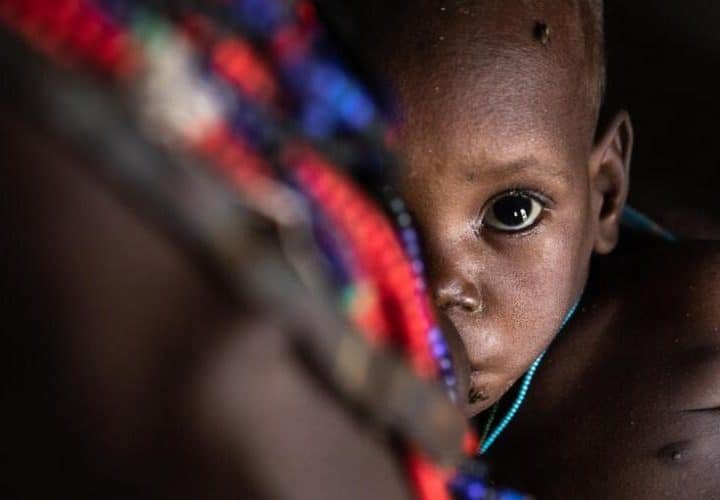 Appel à projets nutrition en Éthiopie doté de 40 millions d’euros